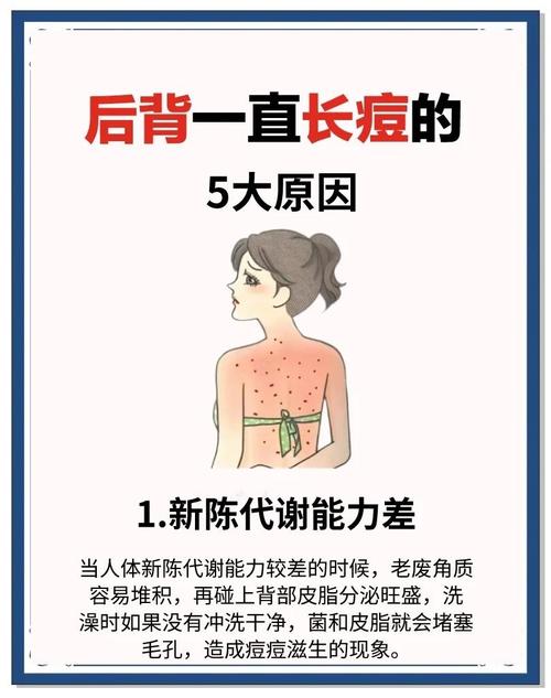 扛油扛痘是祛痘的意思吗？-图1