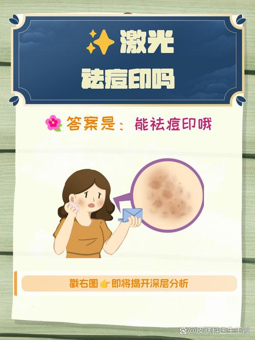 激光祛痘去痘印效果如何？-图1