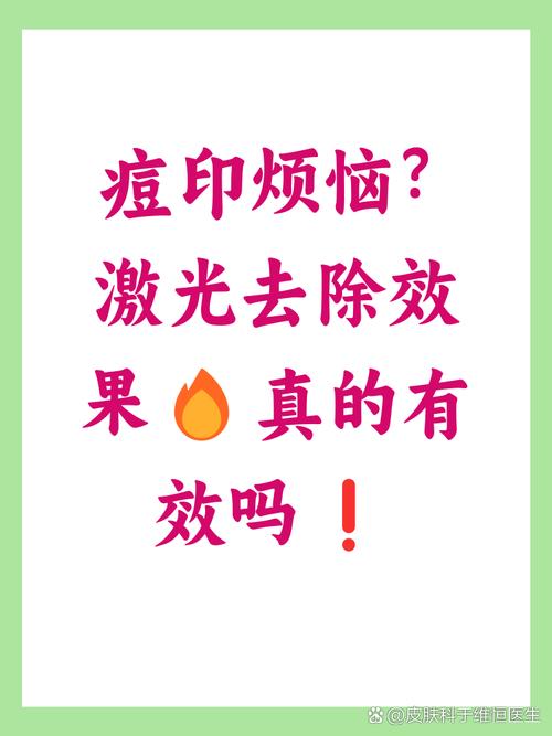 激光祛痘去痘印效果如何？-图3