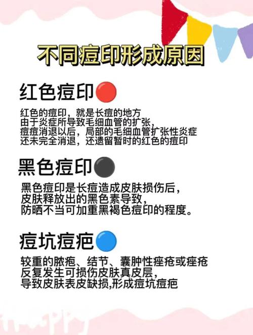 祛痘印痘坑的最好方法-图2