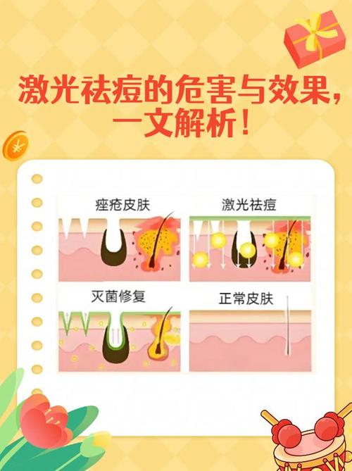 光疗祛痘需先排痘吗？-图1