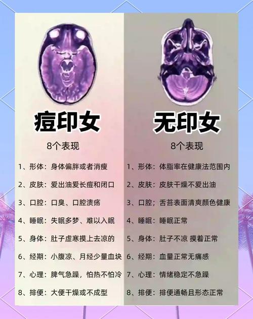 重度青春痘怎么快速祛痘?-图2 重度青春痘怎么快速祛痘?-图2