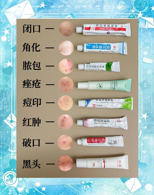 长痘了到底能不能用祛痘产品？-图1