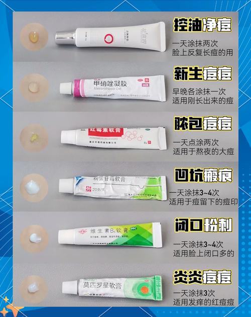 祛痘药膏怎么选？有效祛痘用什么？-图1