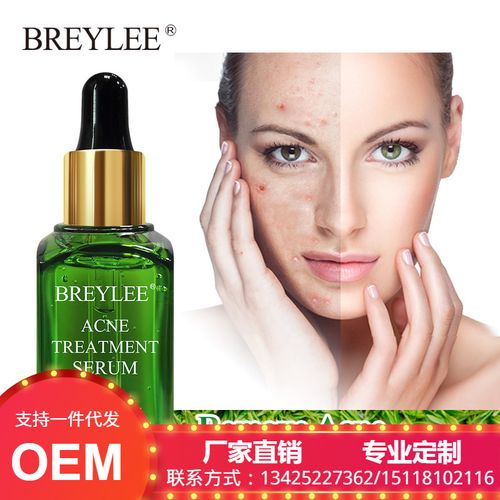 美国祛痘产品效果到底怎么样？-图2