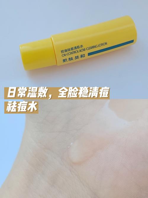 albion湿敷祛痘真的有效吗?-图1 albion湿敷祛痘真的有效吗?-图1