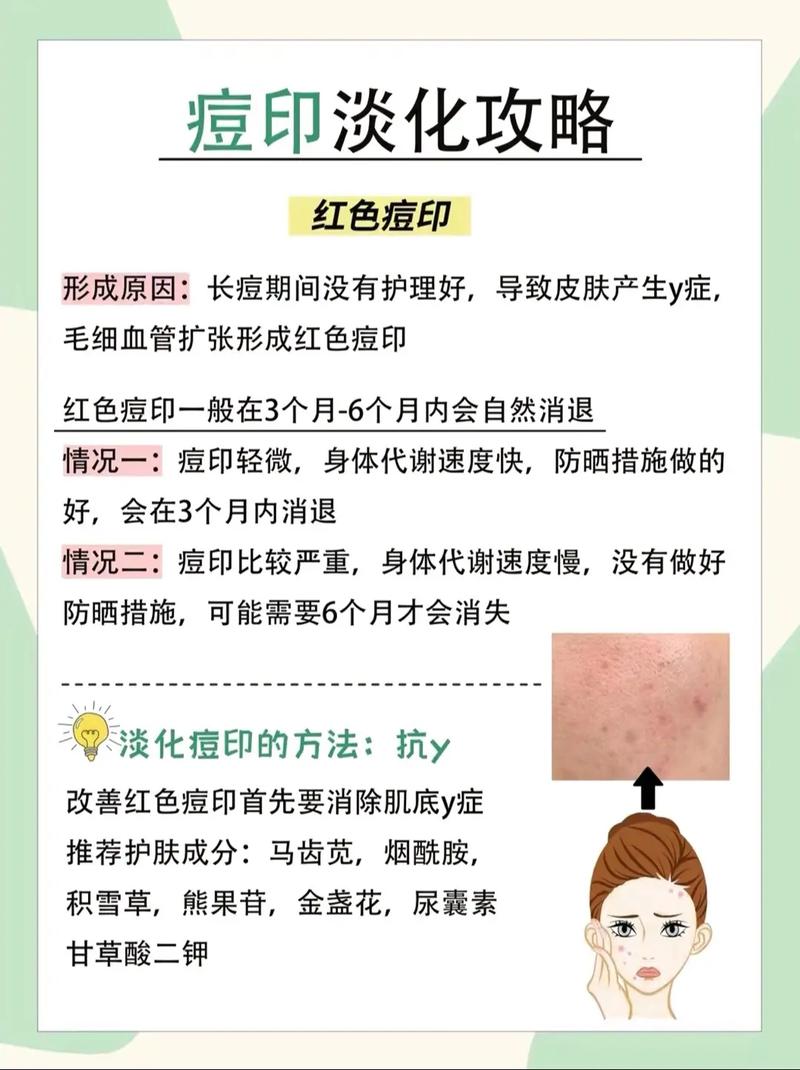 祛痘印痘坑，什么方法最有效？-图2
