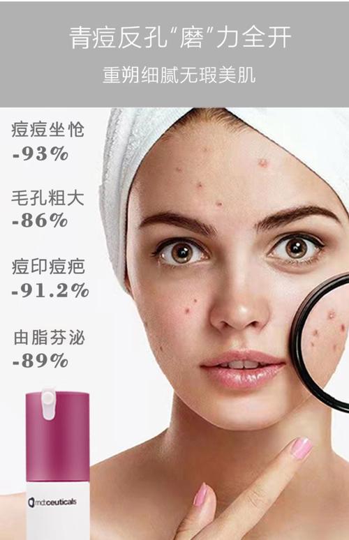 祛痘印祛斑产品，哪种才最有效？-图2