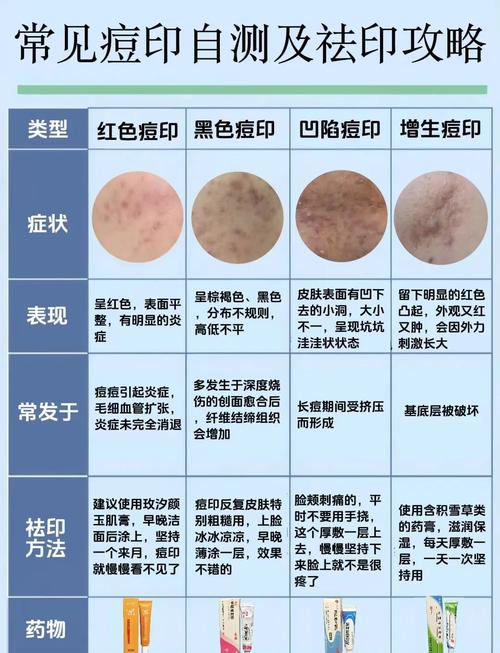 祛痘痕痘印，家用怎么弄才有效？-图1