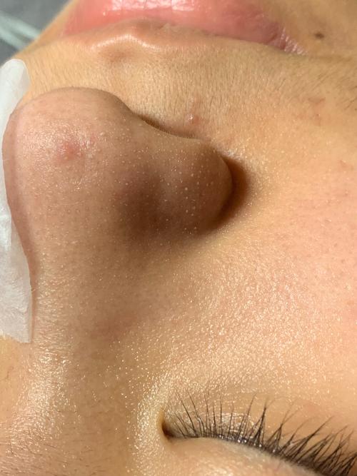 护肤品浮脸不吸收怎么办?-图2 护肤品浮脸不吸收怎么办?-图2