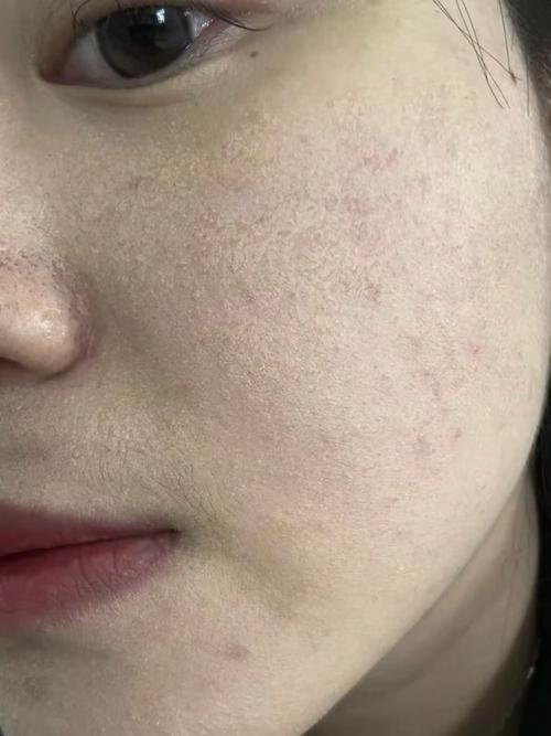 护肤品浮脸不吸收怎么办?-图1 护肤品浮脸不吸收怎么办?-图1