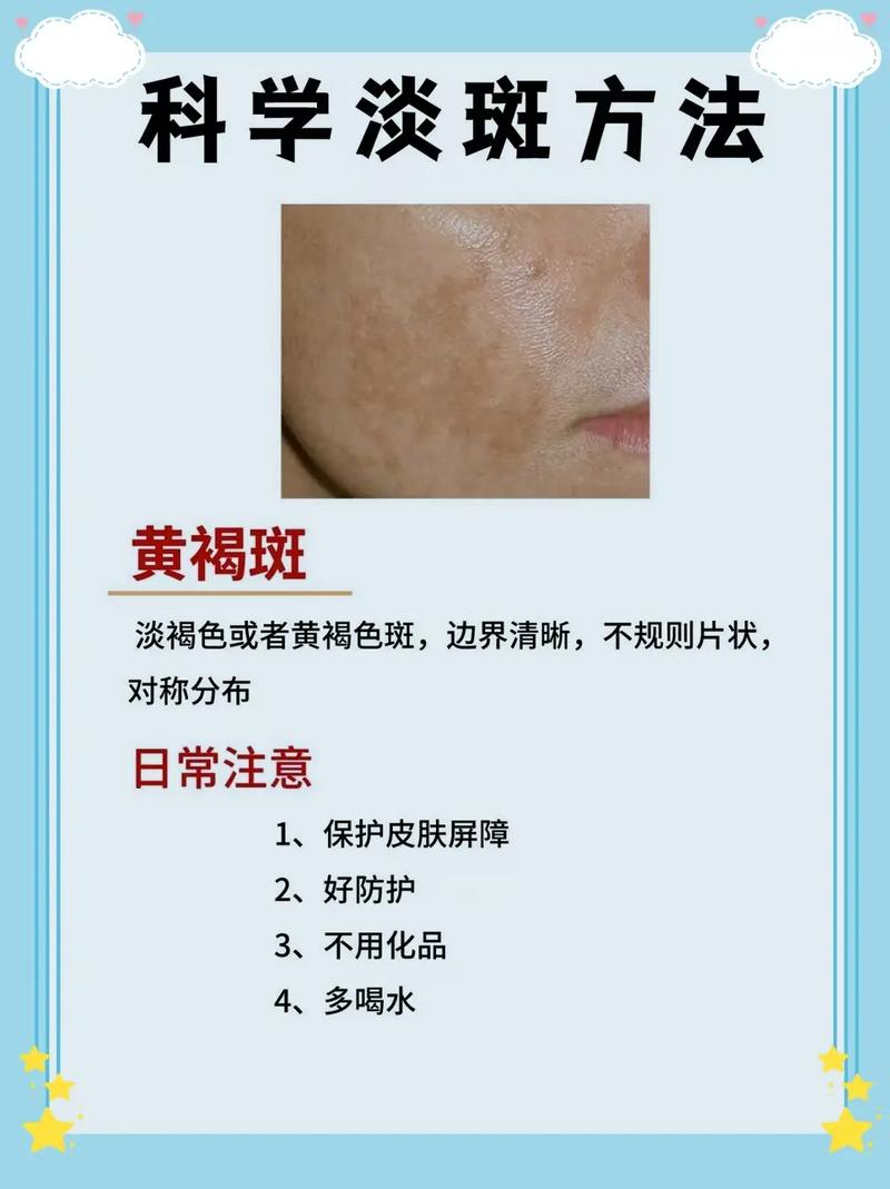 淡盐水祛痘祛斑真有效吗?-图2 淡盐水祛痘祛斑真有效吗?-图2