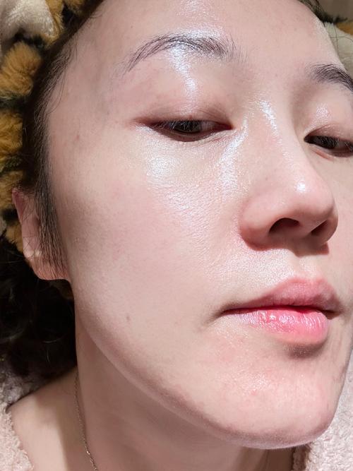 护肤品擦完脸为什么油油的？-图2