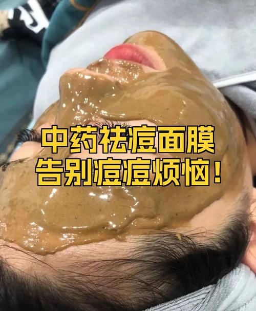 中药祛痘面膜为何用着反而爆痘？-图2