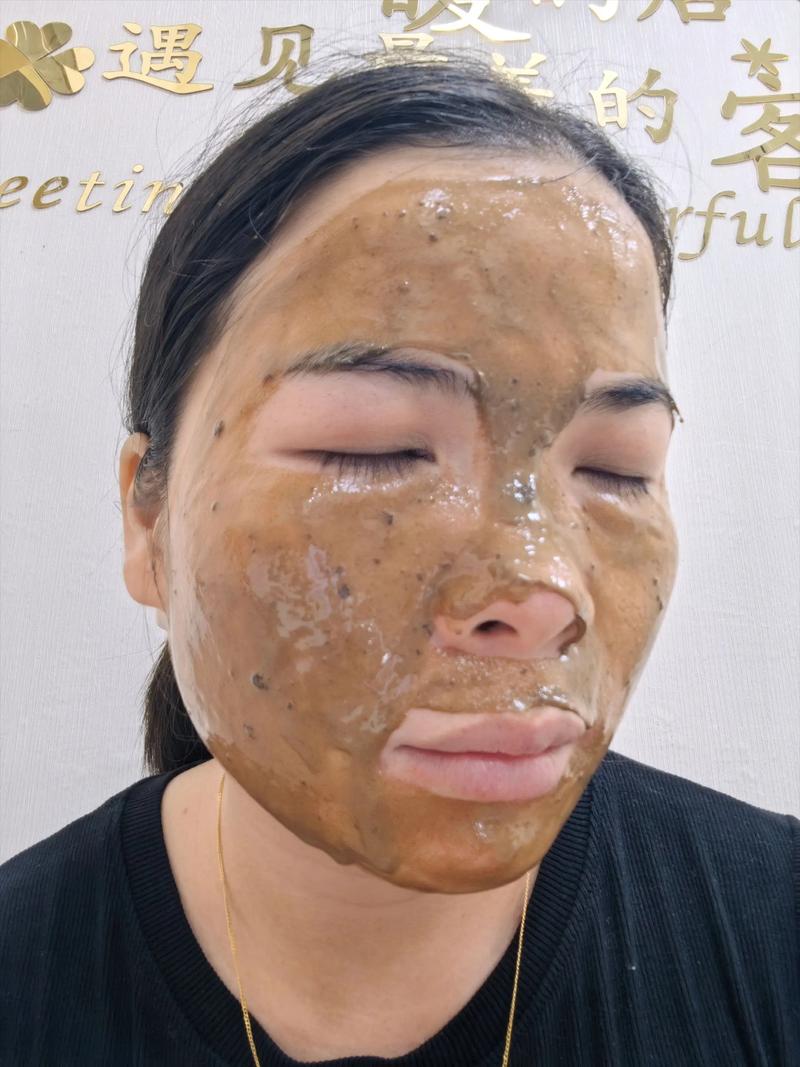 自制面膜真能祛痘祛斑吗？-图3