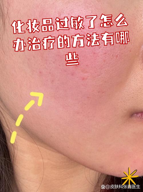 护肤品用几天才过敏，是哪里出了问题？-图1