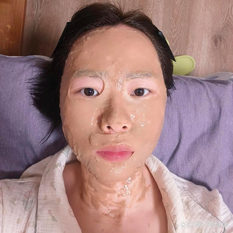 自制面膜真的能祛痘祛痘印吗？-图1