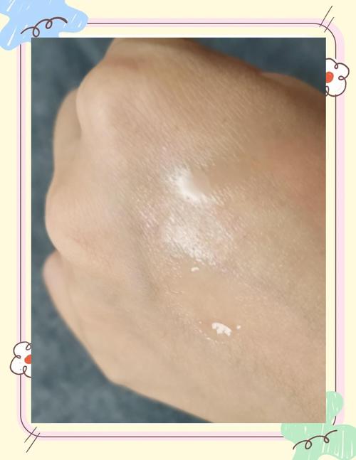 控油祛痘精油真的能祛痘吗？-图2