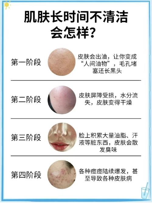 不护肤的女人，皮肤会怎样变化？-图3