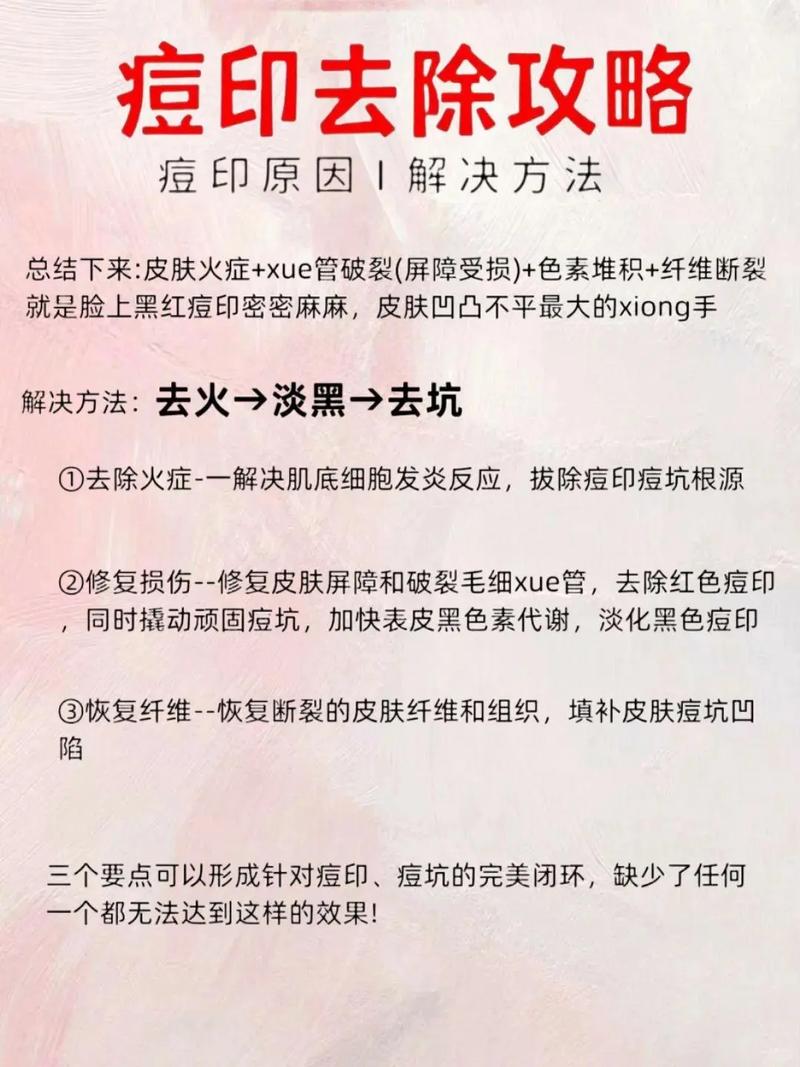 蜂蜜真的能祛痘印、祛痘吗?-图3 蜂蜜真的能祛痘印、祛痘吗?-图3