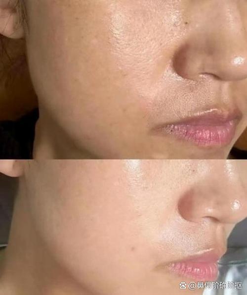 欧瑞莲祛痘套装价格是多少？-图2