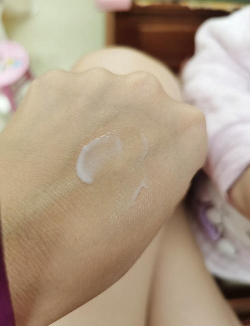 标婷维生素E乳能祛痘印吗？-图1