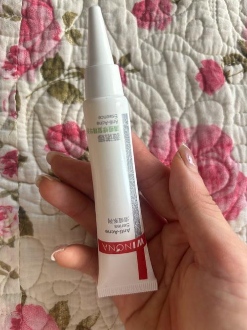 女生祛痘产品怎么选才有效？-图3