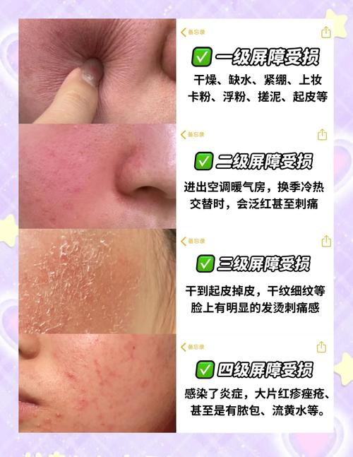 护肤品过敏了，该怎么办？-图1