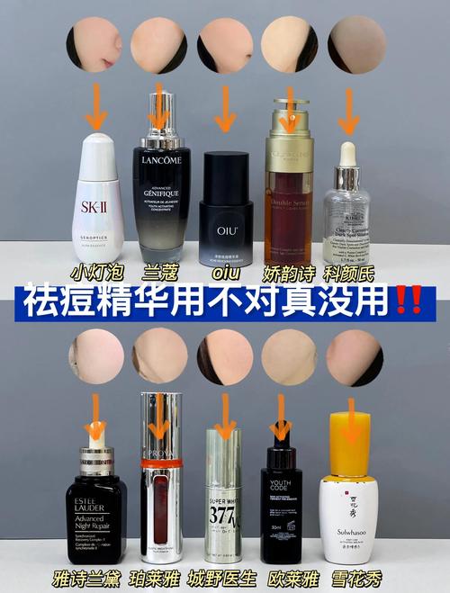 祛痘精华液怎么用才有效？-图2