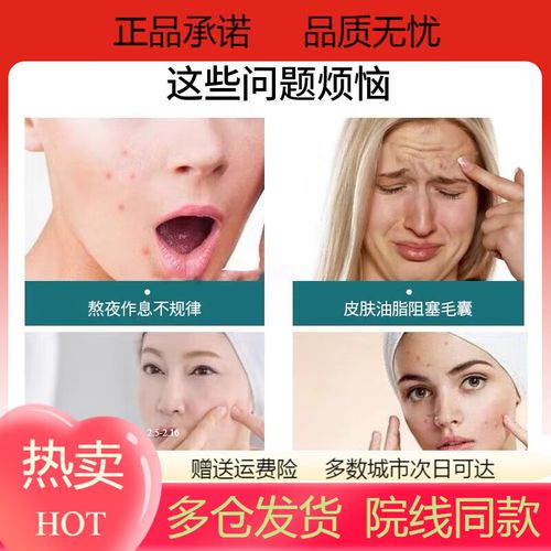 喜马拉雅祛痘的好用吗-图2