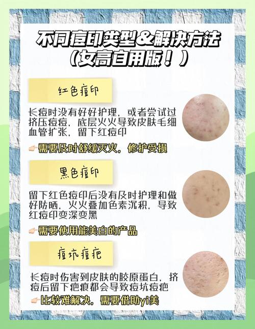 激光祛痘印要多久见效？-图2