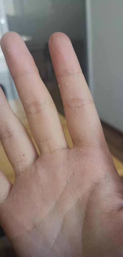 狮王祛痘膏搓泥是质量问题吗？-图2