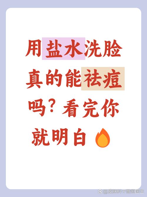 盐水洗脸真能祛痘印吗?-图1 盐水洗脸真能祛痘印吗?-图1