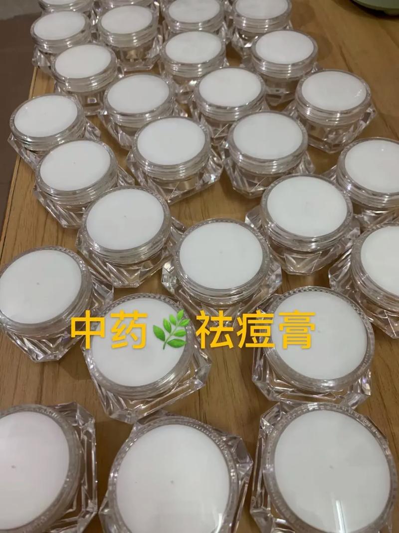 老中医祛痘效果真的好吗？-图2