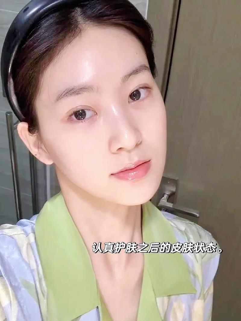 维生素E祛痘要多久才见效？-图2