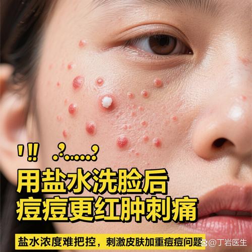 男生用盐洗脸真能祛痘吗？-图2