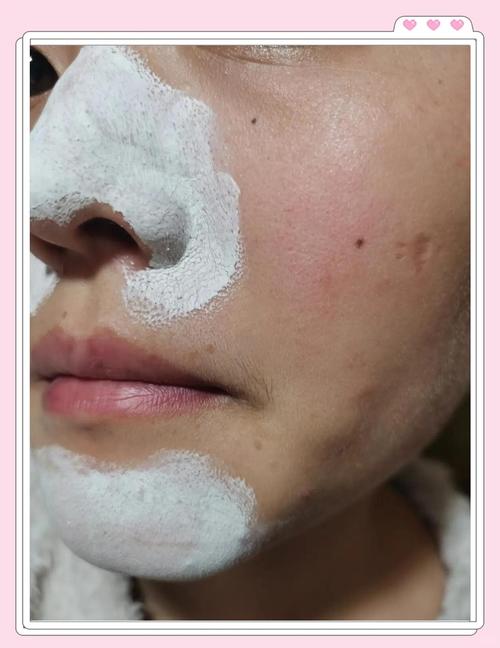 护肤品擦脸后搓泥是咋回事？-图1