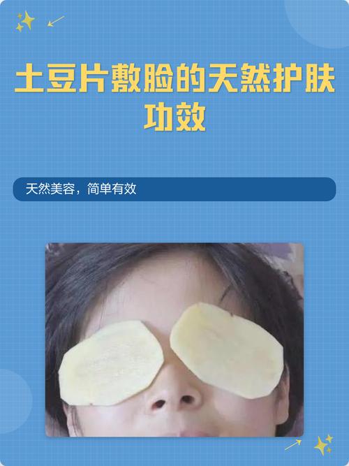 土豆敷脸多久能祛痘？-图1