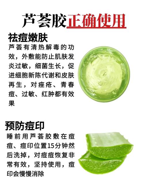 祛痘芦荟胶真能最好吗？-图2