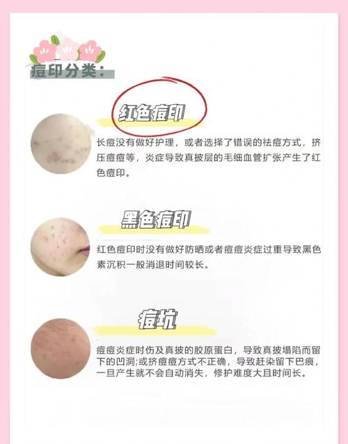 美肤宝安心祛痘正确用法是什么？-图1