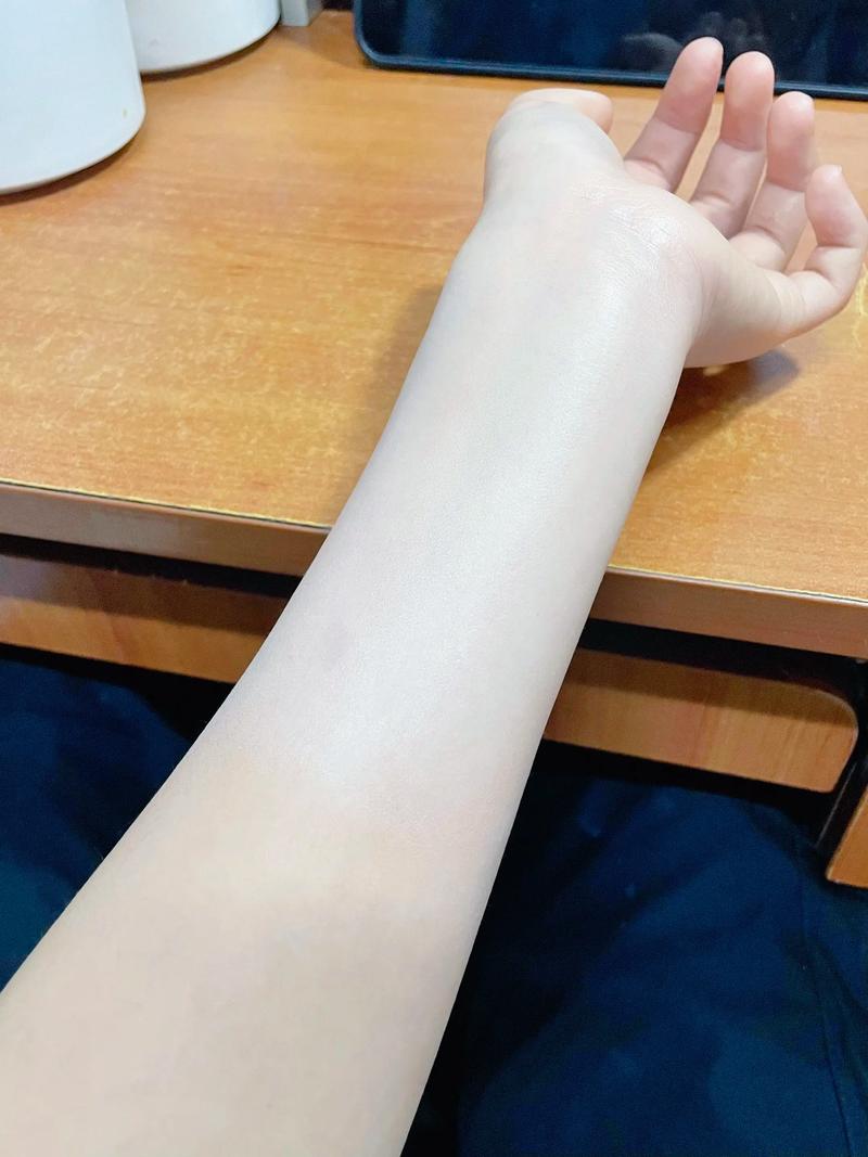 连翘祛痘美肤霜效果真的好吗?-图2 连翘祛痘美肤霜效果真的好吗?-图2