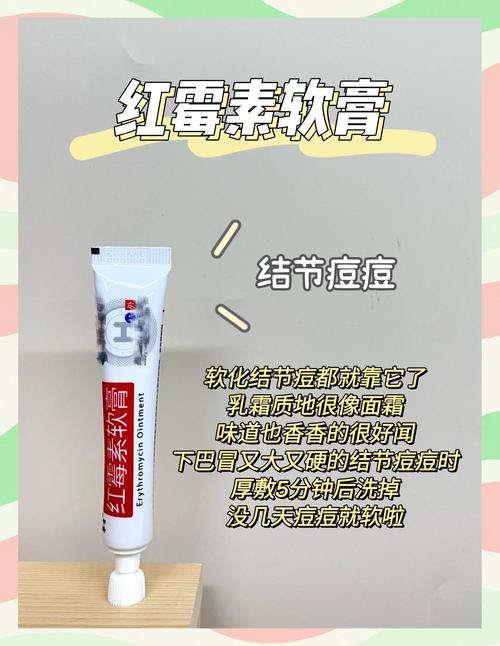 敷面膜后擦祛痘膏会搓泥吗？-图3