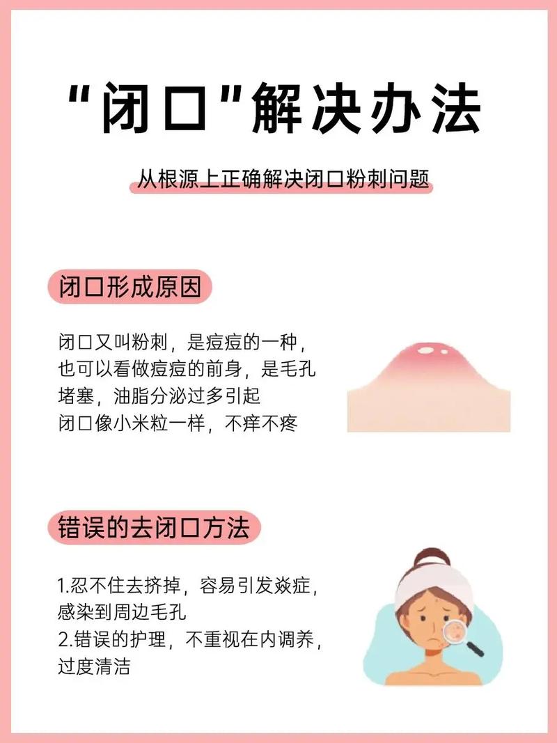 角质层薄祛闭口痘，怎么安全有效？-图2
