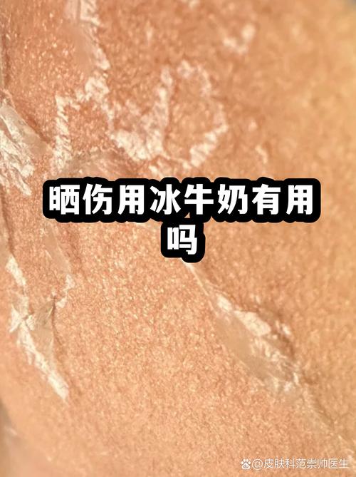 牛奶敷脸真能祛痘吗？-图1