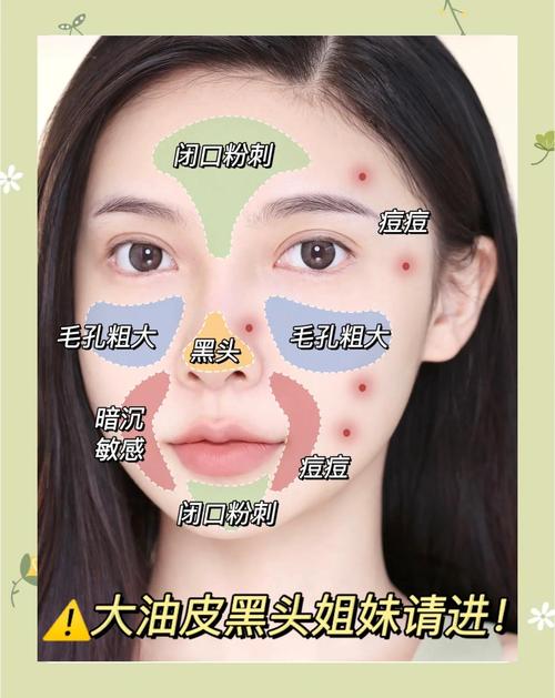 祛痘去黑头美白，哪种方法最有效？-图3