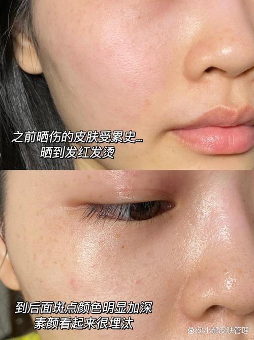 擦完护肤品脸反光,是营养过剩还是过敏了?-图1 擦完护肤品脸反光,是营养过剩还是过敏了?-图1