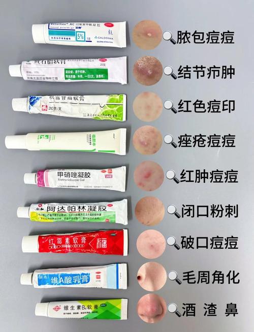 日本祛痘印产品哪个最有效？-图2