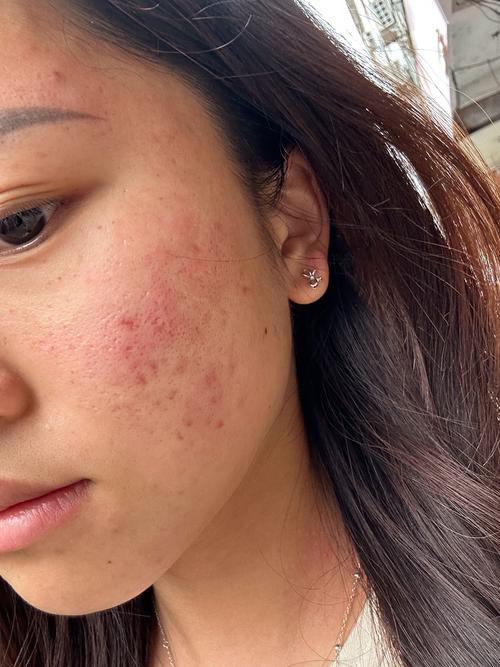 护肤品用后脸泛油,是哪步出错了?-图1 护肤品用后脸泛油,是哪步出错了?-图1