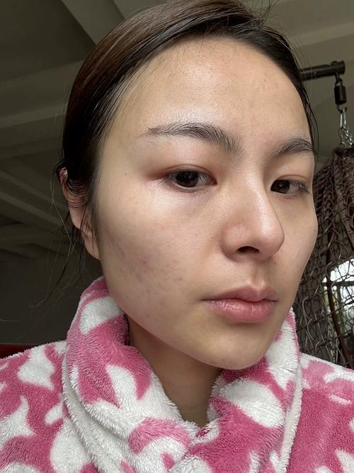 护肤品用后脸泛油,是哪步出错了?-图2 护肤品用后脸泛油,是哪步出错了?-图2