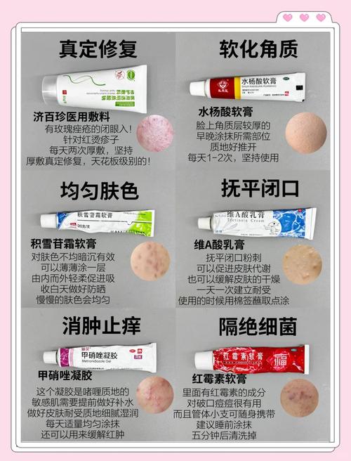 粉红祛痘溶解膏正确用法是什么?-图2 粉红祛痘溶解膏正确用法是什么?-图2